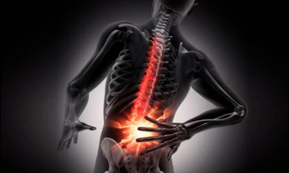 Ortopedica-Hernia-de-Disco-e-tipos-de-cirurgias